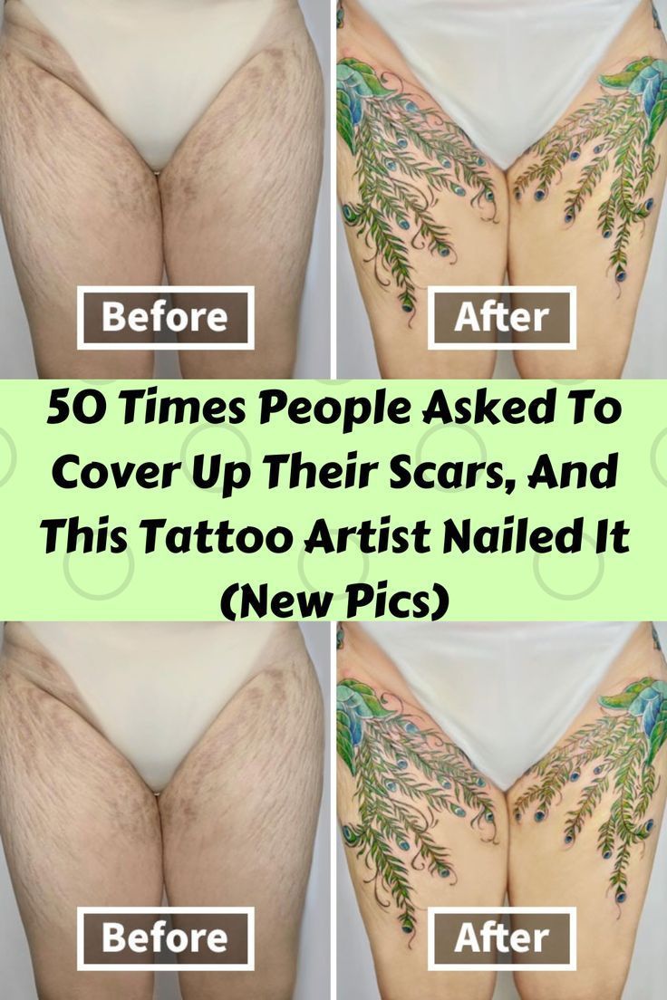 50 Times People Asked To Cover Up Their Scars And This Tattoo Artist 50 Times People Asked To Cover Up Their Scars And This Tattoo Artist