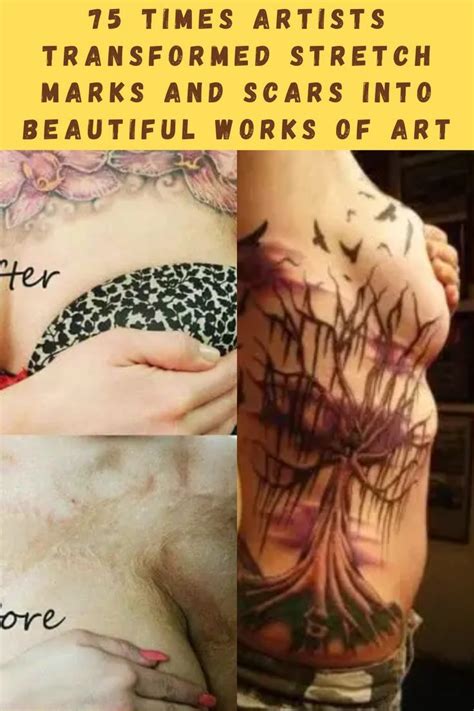 75 Times Artists Transformed Stretch Marks And Scars Into Beautiful 75 Times Artists Transformed Stretch Marks And Scars Into Beautiful