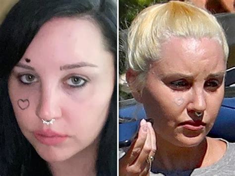 Amanda Bynes Is Removing Her Face Tattoo Shows Her Progress In New Amanda Bynes Is Removing Her Face Tattoo Shows Her Progress In New