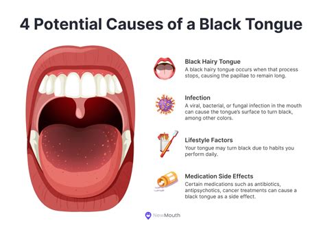 Identify And Treat Black Dots On Tongue: Causes, Risks, And Remedies