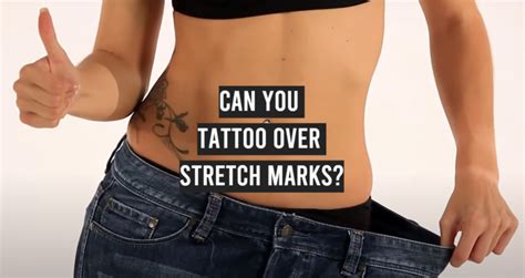 Can You Tattoo Over Stretch Marks Tattooprofy Can You Tattoo Over Stretch Marks Tattooprofy