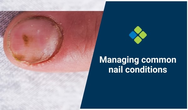 Common Nail Conditions Diagnosis And Treatment Options
