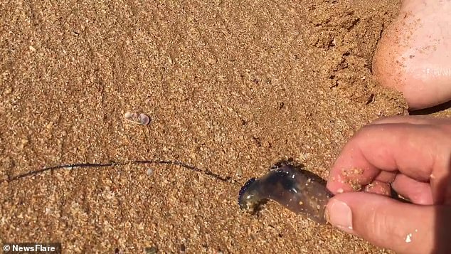Curious Man Stings Himself On The Foot With A Blue Bottle Twice To Test Curious Man Stings Himself On The Foot With A Blue Bottle Twice To Test