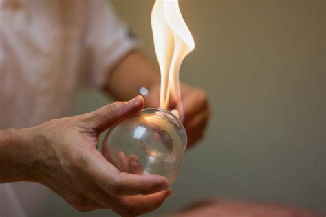 Is Fire Cupping Treatment Right For You?