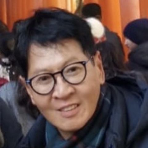 I Started Going Bald At 25 A Hair Transplant Changed My Life