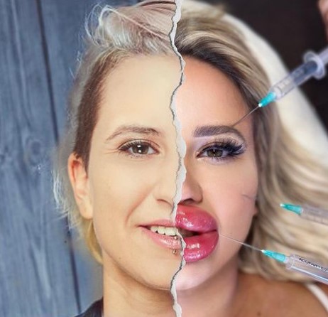 Jessy Bunny Plastic Surgery Transforming Into A Human Barbie Doll Jessy Bunny Plastic Surgery Transforming Into A Human Barbie Doll