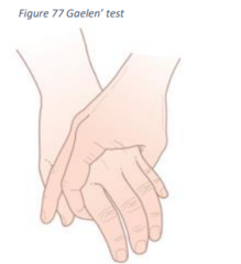 Mortons Test Tests For Foot Pain And Neuroma: A Clinician's Tale