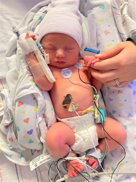 Nickeles For Nicu: Practical Ways To Ease Nicu Costs